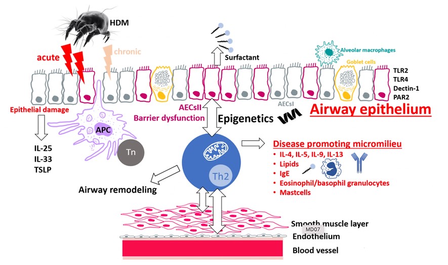 Übersichtsgrafik zu allergischem Asthma